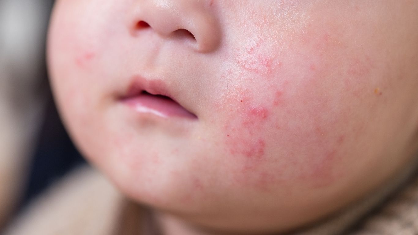 Pharmacist consulting with a patient about a minor skin condition